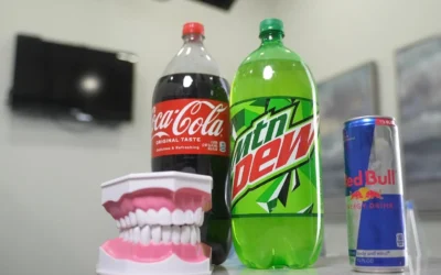 What Are The Worst Drinks For Your Teeth?