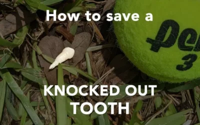 How To Save A Knocked Out Tooth