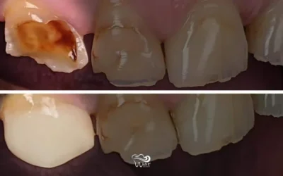 Will the Dentist Judge Me for My Teeth?