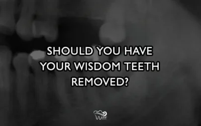 Do You Need To Have Your Wisdom Teeth Removed?