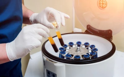 How Can PRF Help With Dental Implants?