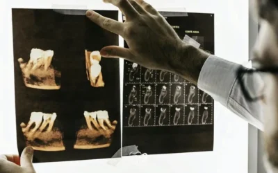 Are Dental X-Rays Safe?